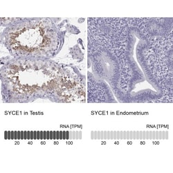 SYCE1 Antibody, Novus Biologicals 25 &mu;L; Unlabeled:Antibodies, Polyclonal